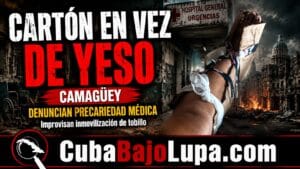 CARTÓN EN VEZ DE YESO: LA PRECARIEDAD MÉDICA GOLPEA EN CAMAGÜEY